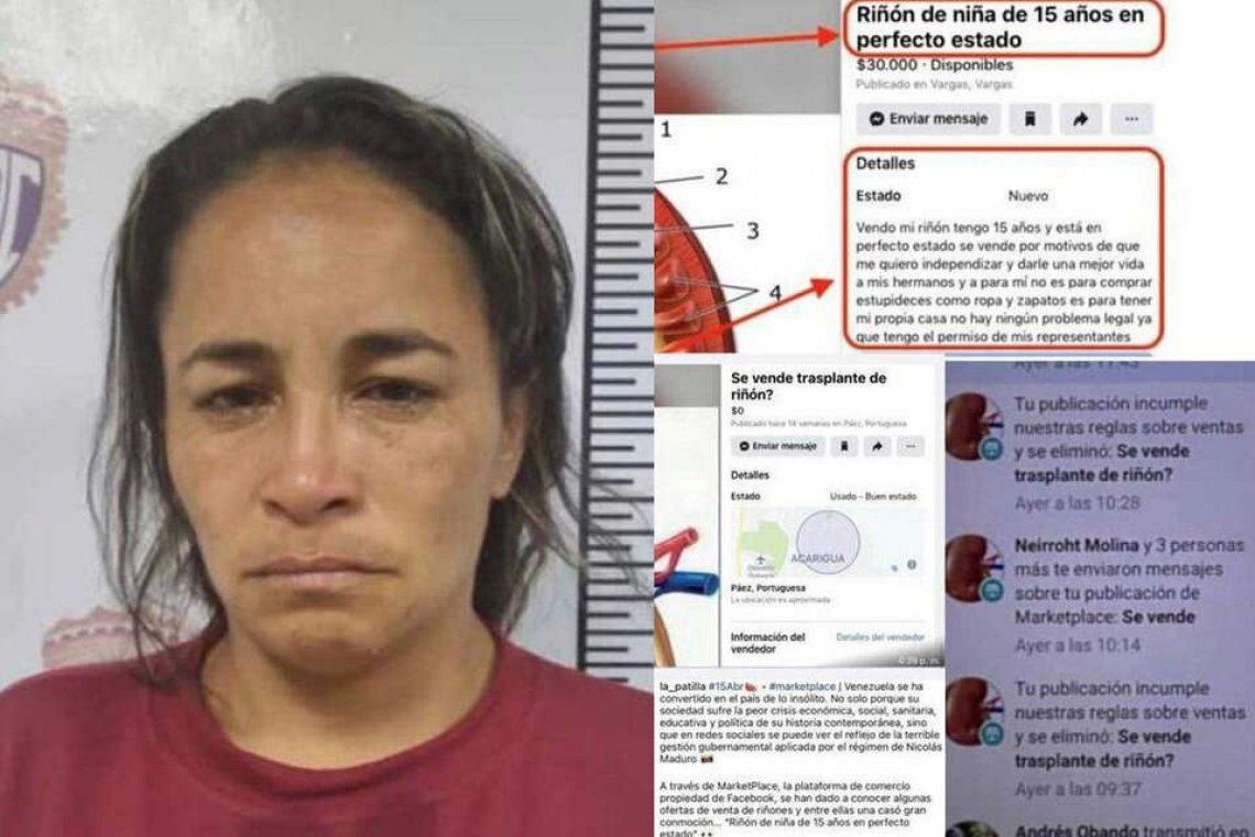 Detenida por vender el riñón de una nena