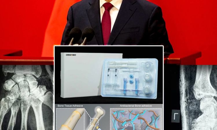 CHINA: AVANZA LAS PRUEBAS DE UN PEGAMENTO PARA REPARAR HUESOS EN HUMANOS 