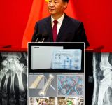 CHINA: AVANZA LAS PRUEBAS DE UN PEGAMENTO PARA REPARAR HUESOS EN HUMANOS 